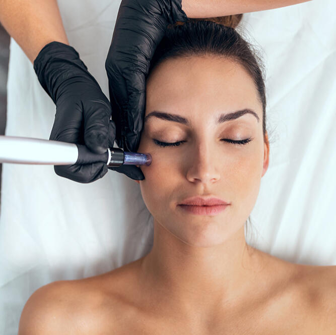 Microneedling